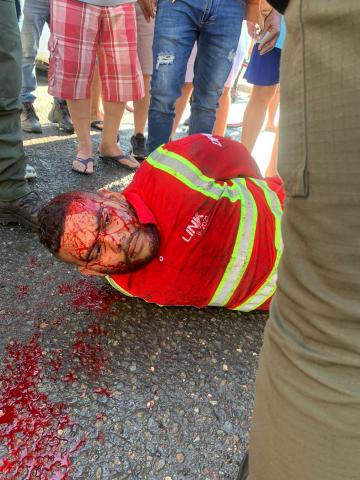 Aspecto del guardia de seguridad herido durante el asalto. 